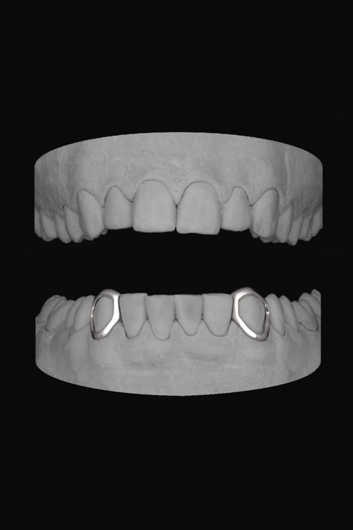 2 x Canine Windows (Lower) - Image 1