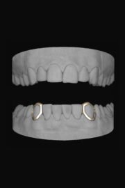 2 x Canine Windows (Lower) - Image 2