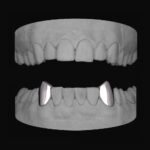 Vampire Canines (Lower)