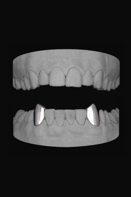 Vampire Canines (Lower)