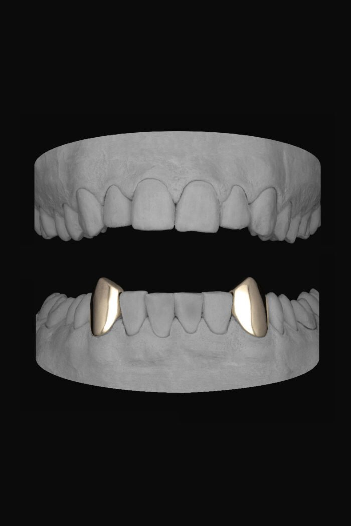 Vampire Canines (Lower) - Image 2