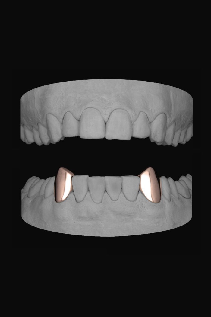 Vampire Canines (Lower) - Image 3