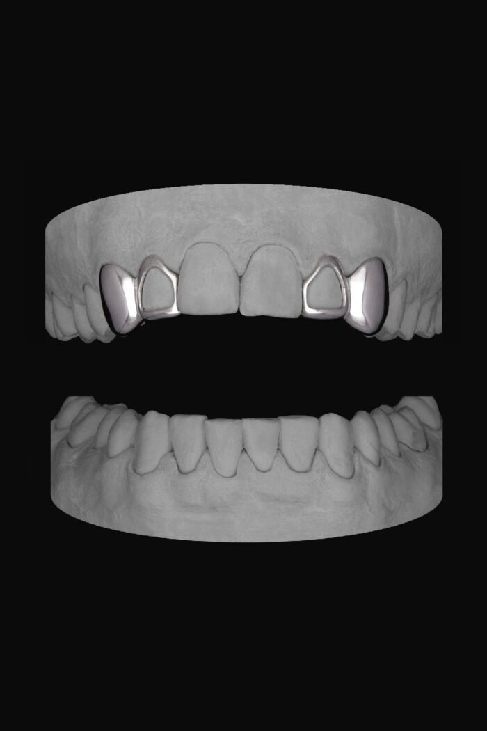 2 x Canine & Window Lateral - Image 1