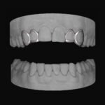 2 x Window Canine & Window Lateral