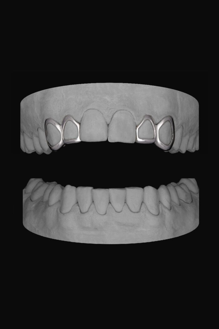 2 x Window Canine & Window Lateral - Image 1