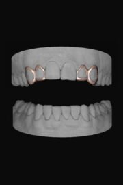 2 x Window Canine & Window Lateral - Image 3