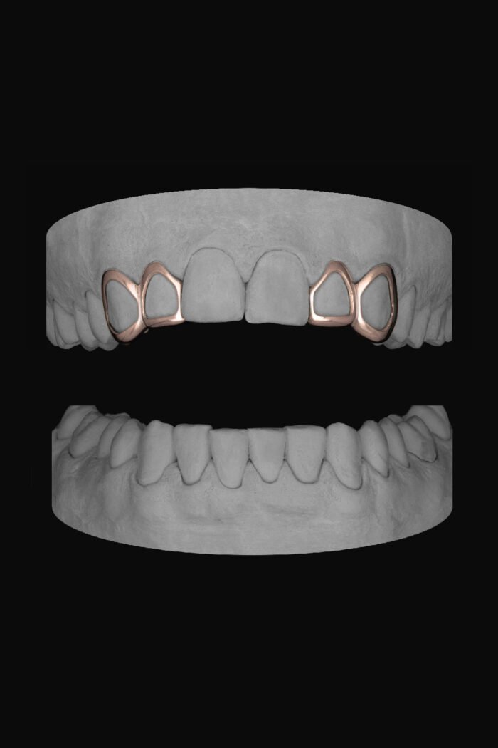 2 x Window Canine & Window Lateral - Image 3