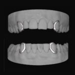 4 x Window Canines