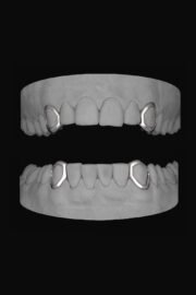 4 x Window Canines
