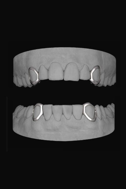 4 x Window Canines