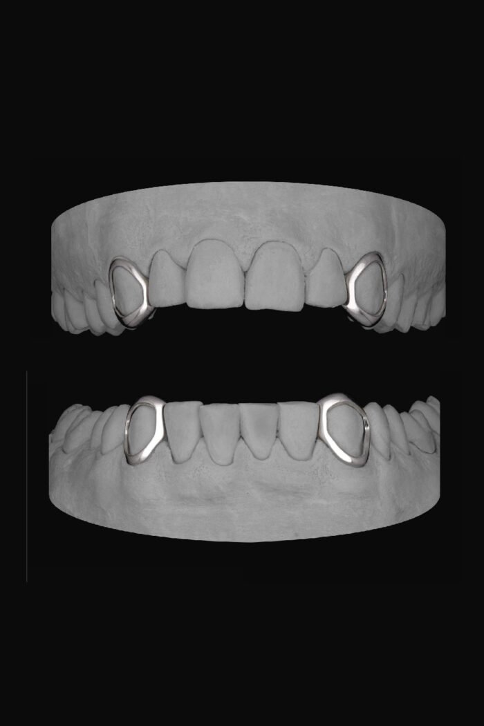 4 x Window Canines - Image 1