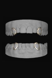 4 x Window Canines - Image 2