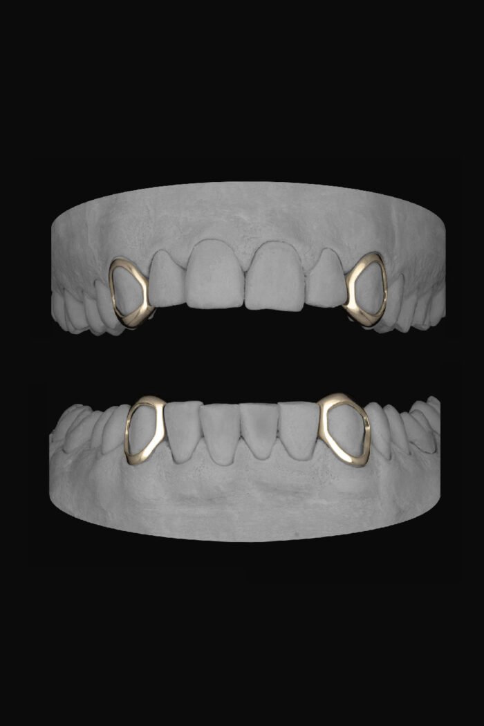 4 x Window Canines - Image 2