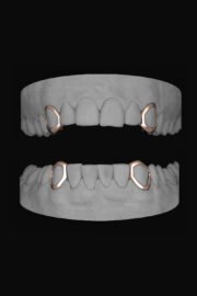 4 x Window Canines - Image 3
