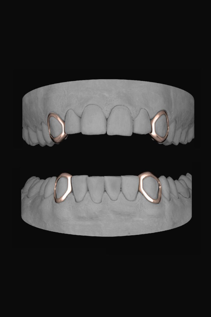 4 x Window Canines - Image 3