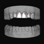 6 Set Window Canines