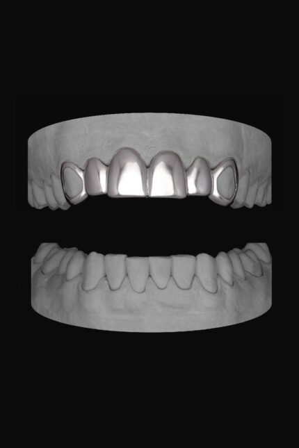 6 Set Window Canines