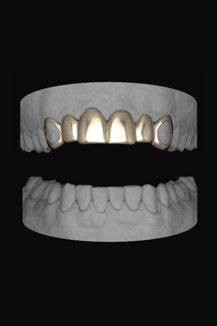 6 Set Window Canines - Image 2