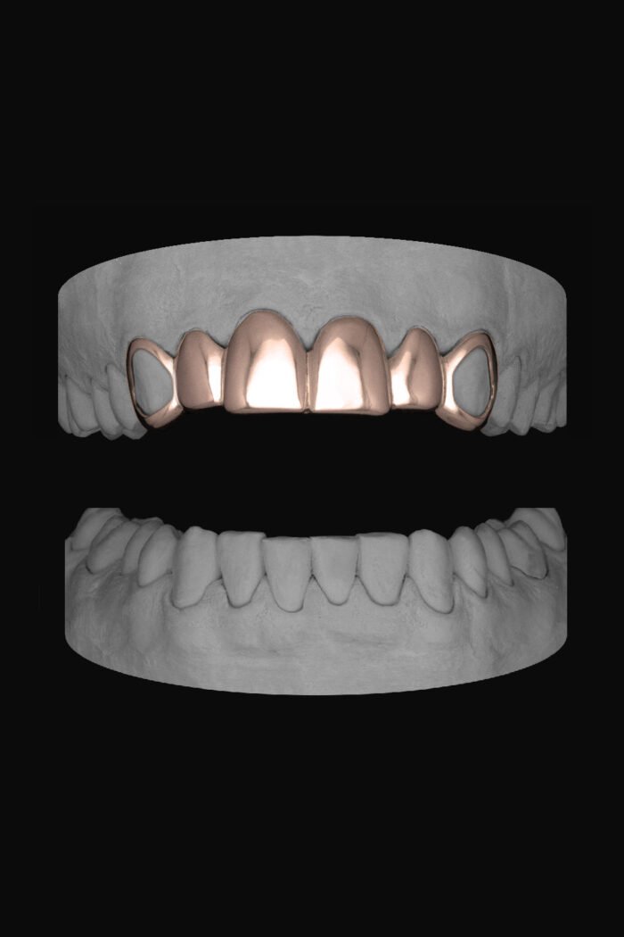 6 Set Window Canines - Image 3