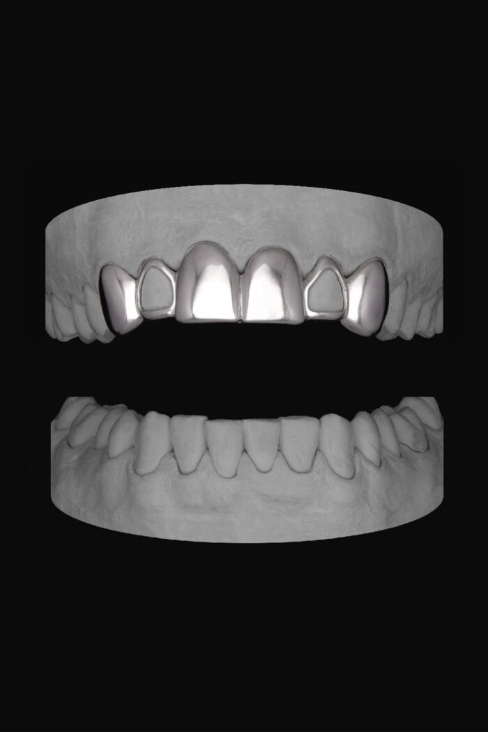 6 Set Window Laterals - Image 1