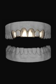 6 Set Window Laterals - Image 2