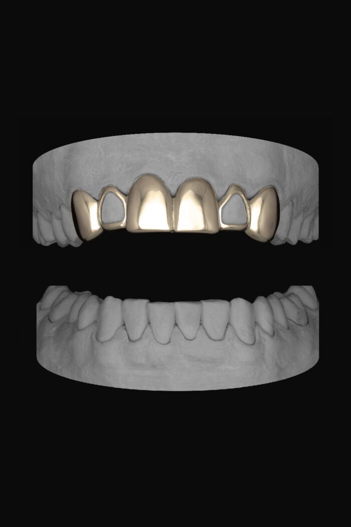 6 Set Window Laterals - Image 2