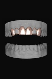 6 Set Window Laterals - Image 3