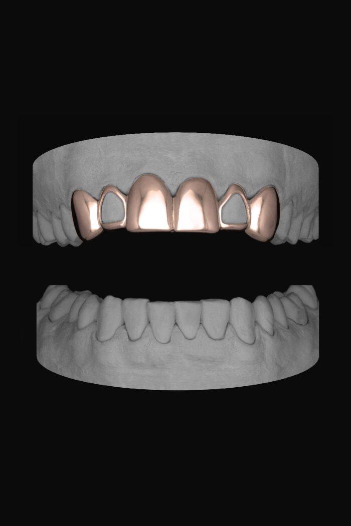 6 Set Window Laterals - Image 3