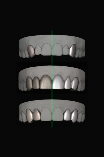 Grillz Polishing