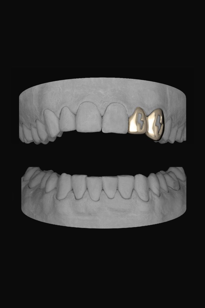 Bolt Lateral & Bolt Canine - Image 2