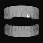 Flame Lateral