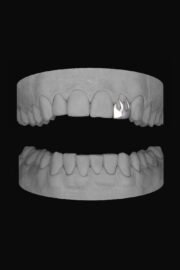 Flame Lateral
