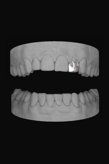 Flame Lateral