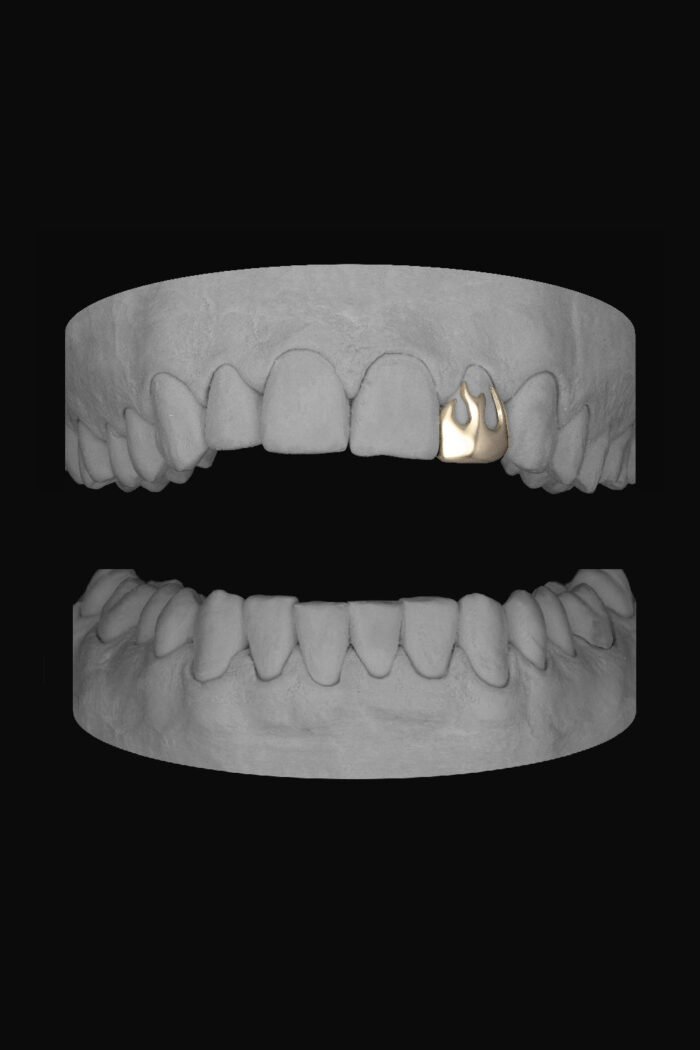 Flame Lateral - Image 2