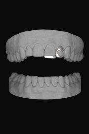 Heart Lateral & Bar
