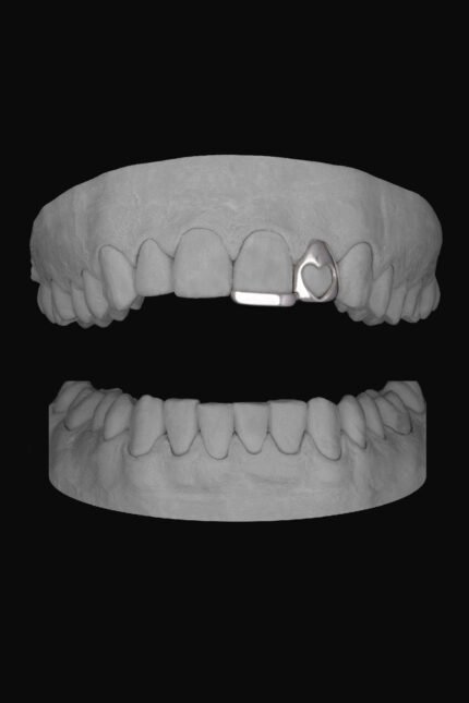 Heart Lateral & Bar
