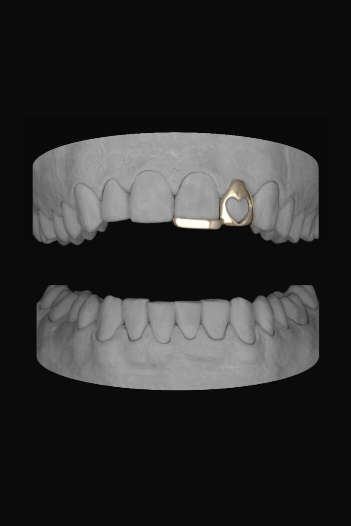 Heart Lateral & Bar - Image 2