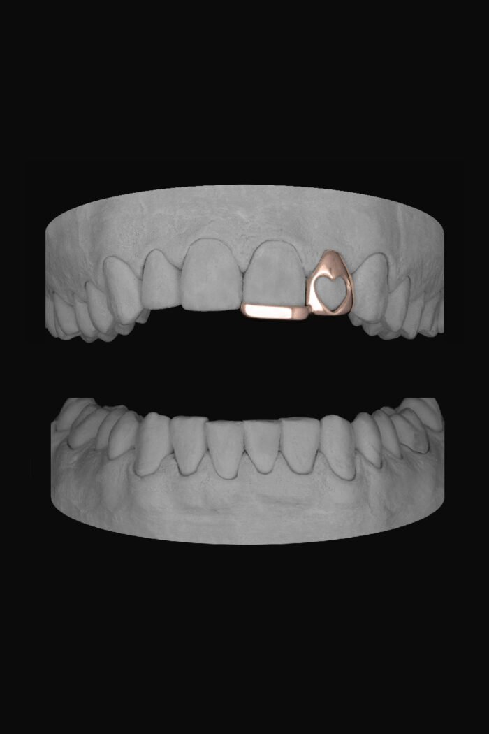 Heart Lateral & Bar - Image 3