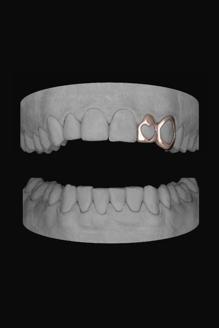 Heart Lateral & Window Canine - Image 3