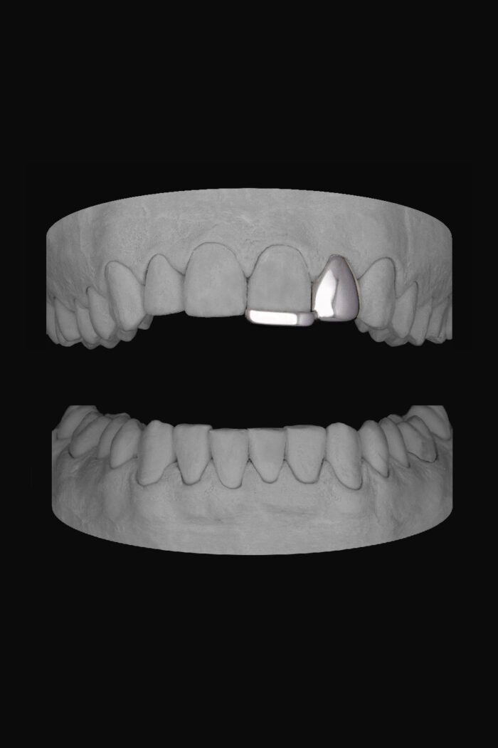 Lateral & Bar - Image 1