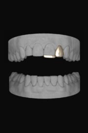 Lateral & Bar - Image 2