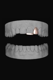 Lateral & Bar - Image 3