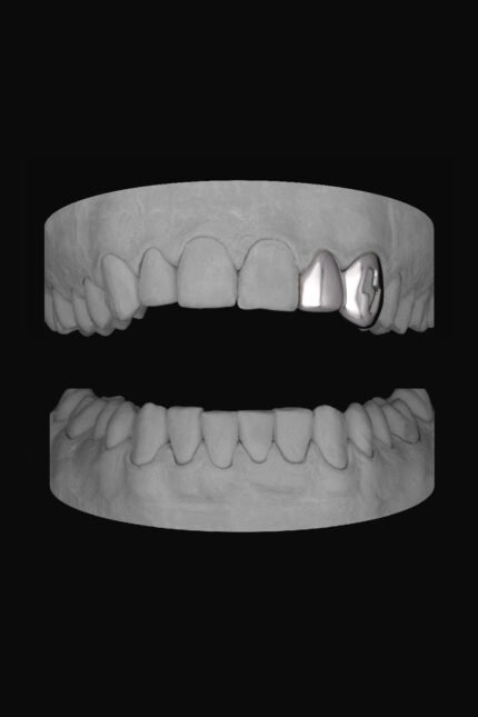 Lateral & Bolt Canine