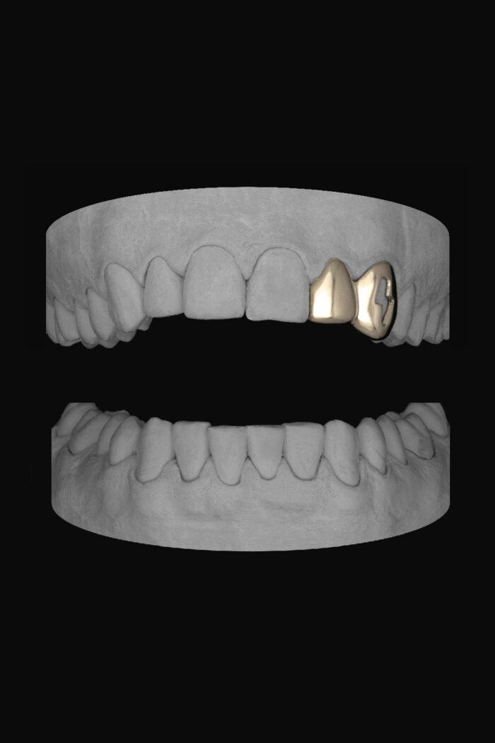 Lateral & Bolt Canine - Image 2
