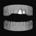 Lateral & Front
