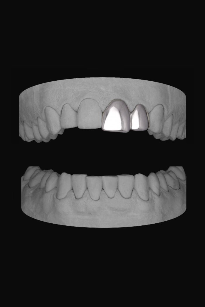 Lateral & Front - Image 1