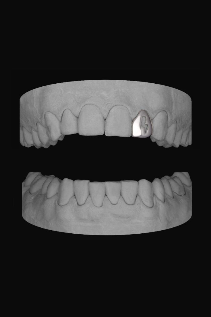 Bolt Lateral - Image 1