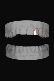 Bolt Lateral - Image 3