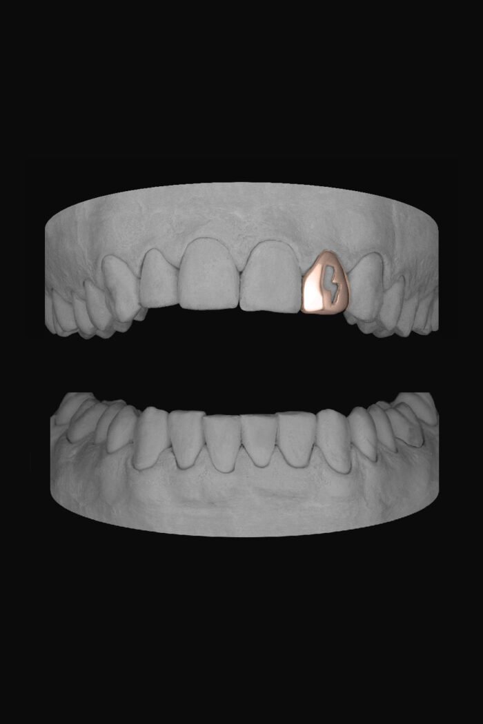 Bolt Lateral - Image 3