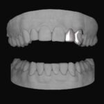 Lateral & Heart Canine